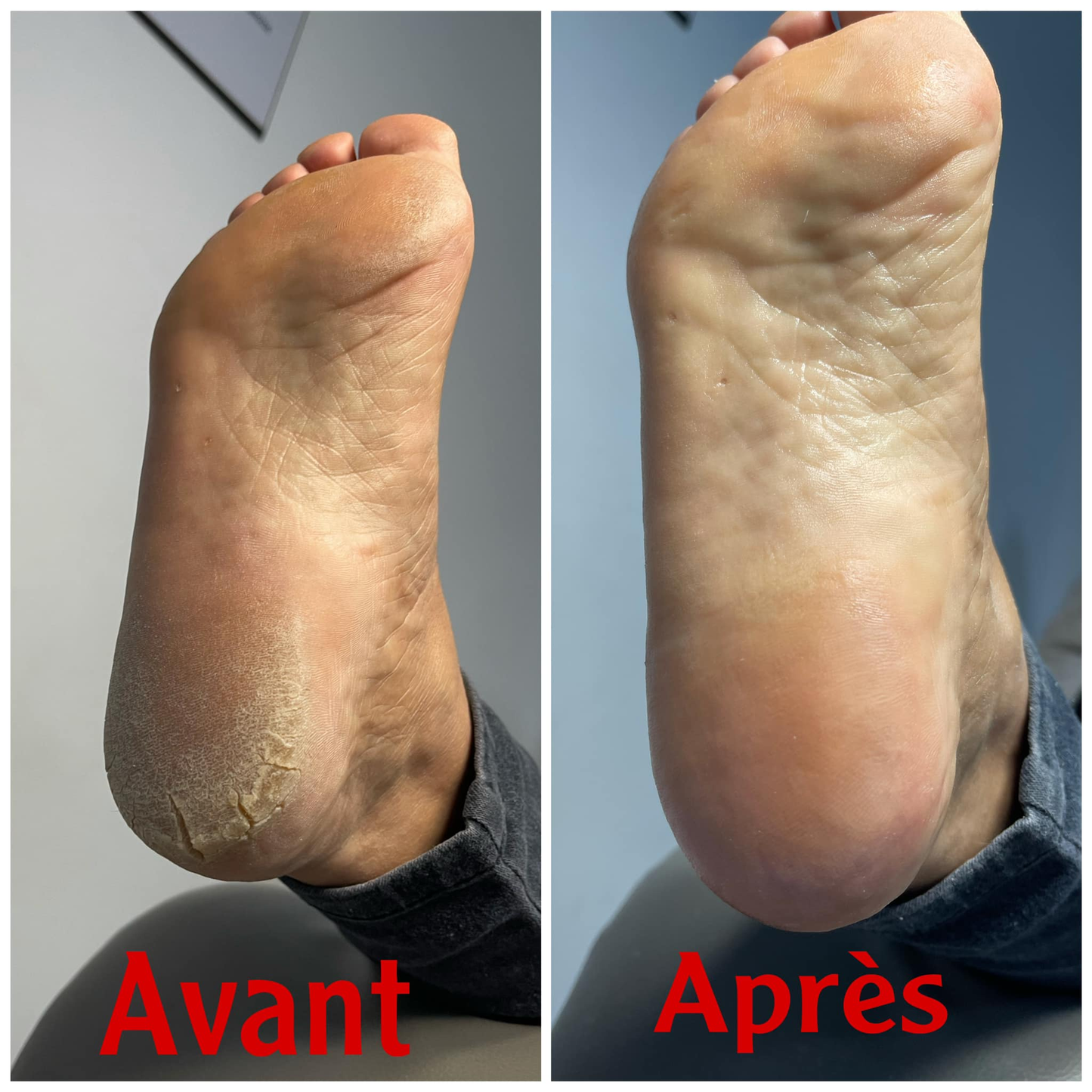 BAUME REPARATEUR ET PROTECTEUR DE PIEDS ET MAINS - ANTI FISSURE